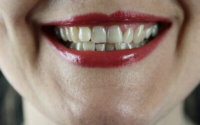 Gum Disease It Can Sneak Up On You