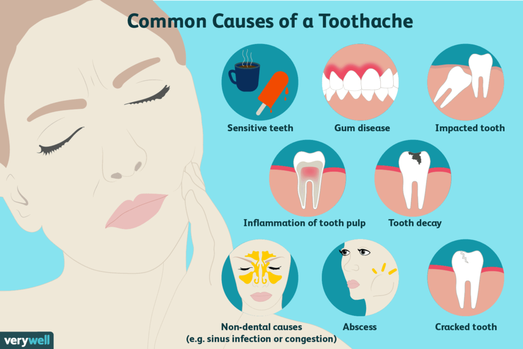 Common causes of tooth pain